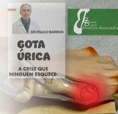 Crise de Gota: o que fazer?