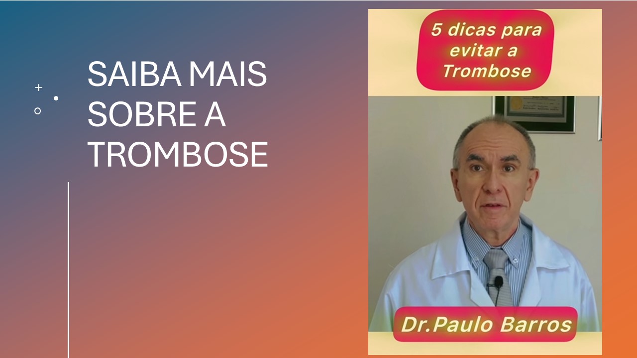 5 DICAS PARA EVITAR A TROMBOSE!